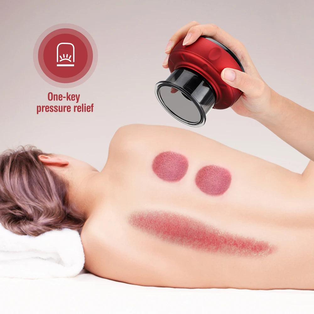 Electric Cupping Massage Device - Heating & Suction Cups