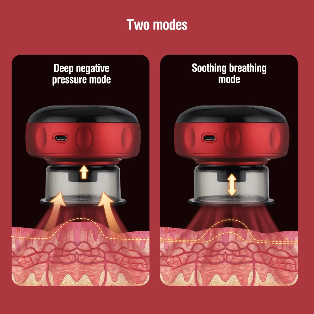 Electric Cupping Massage Device - Heating & Suction Cups