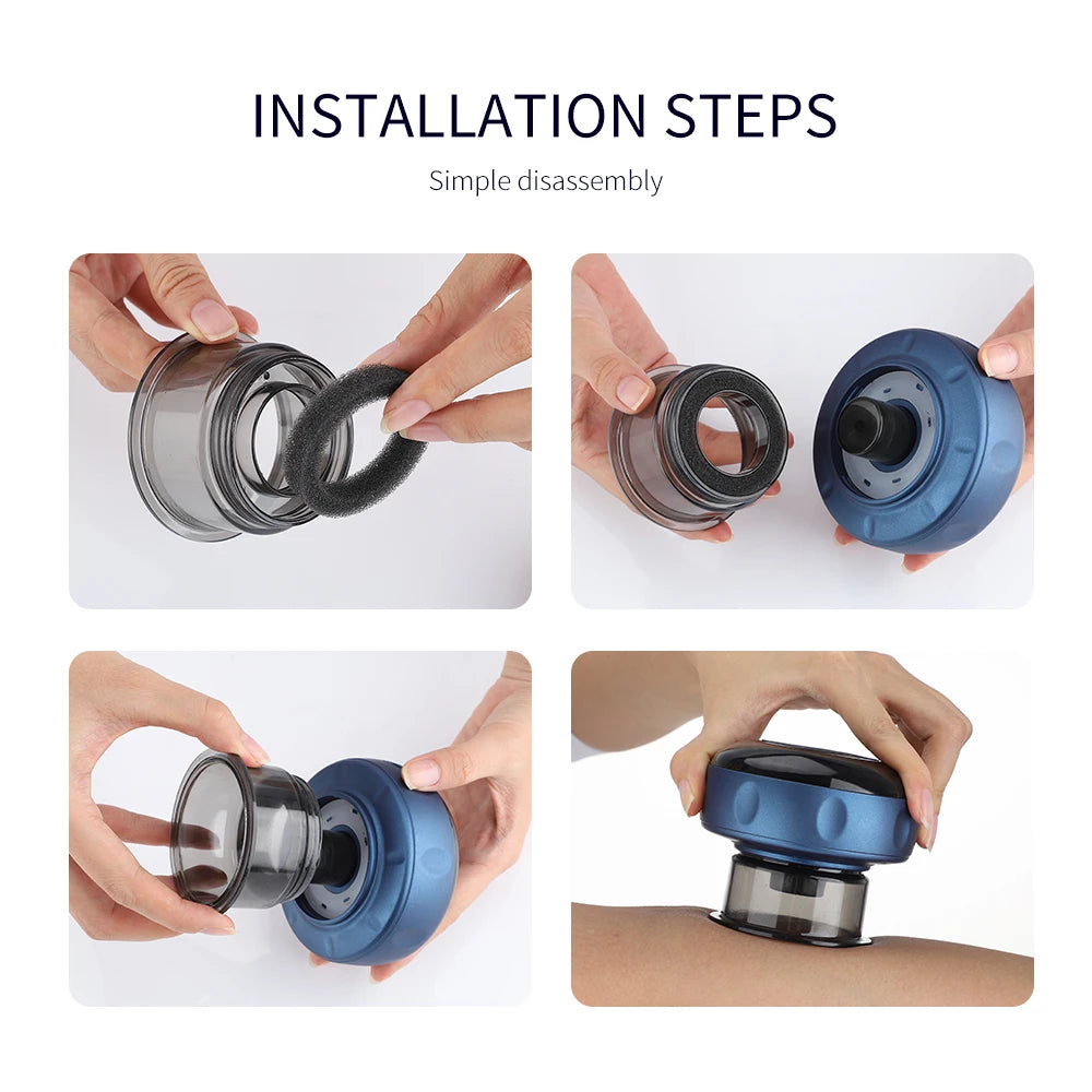 Electric Cupping Massage Device - Heating & Suction Cups