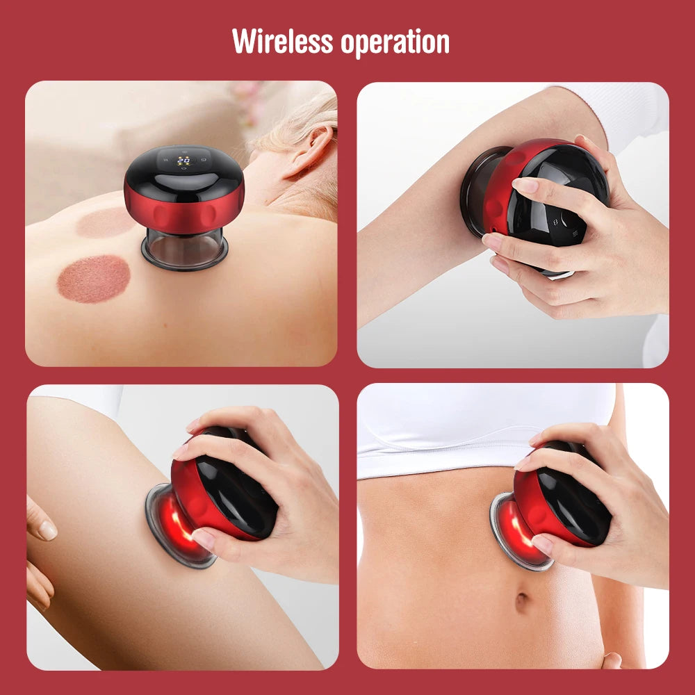 Electric Cupping Massage Device - Heating & Suction Cups