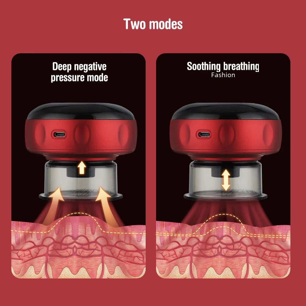 Electric Cupping Massage Device - Heating & Suction Cups